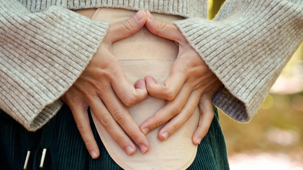 how to stop my ostomy bag from leaking​
