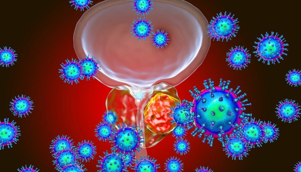 can a bladder infection cause bloating​
