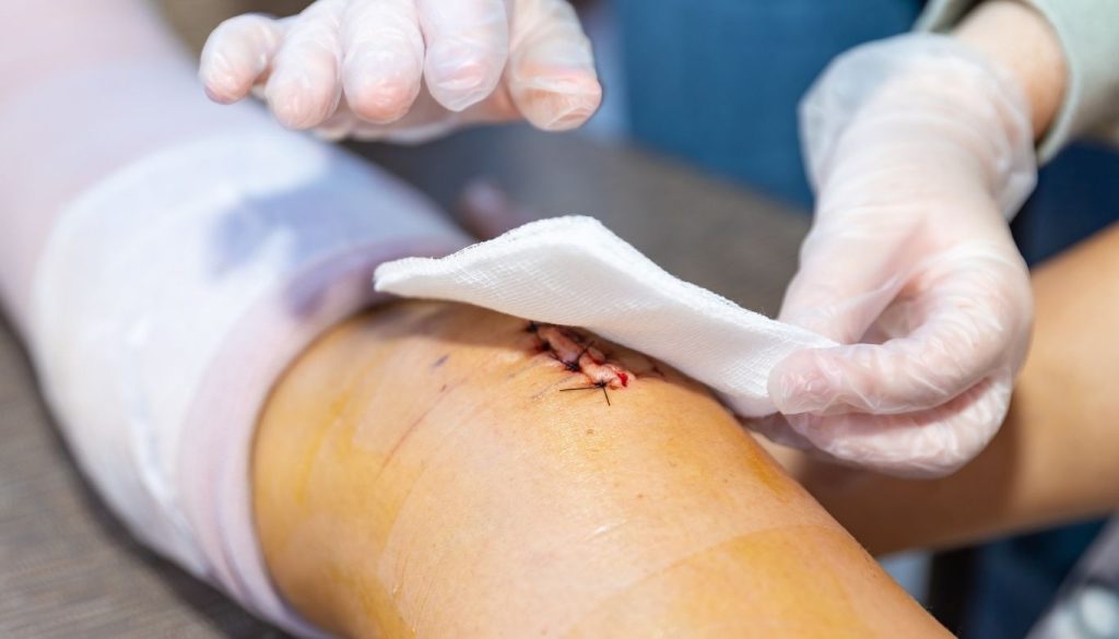 wound care dressings​