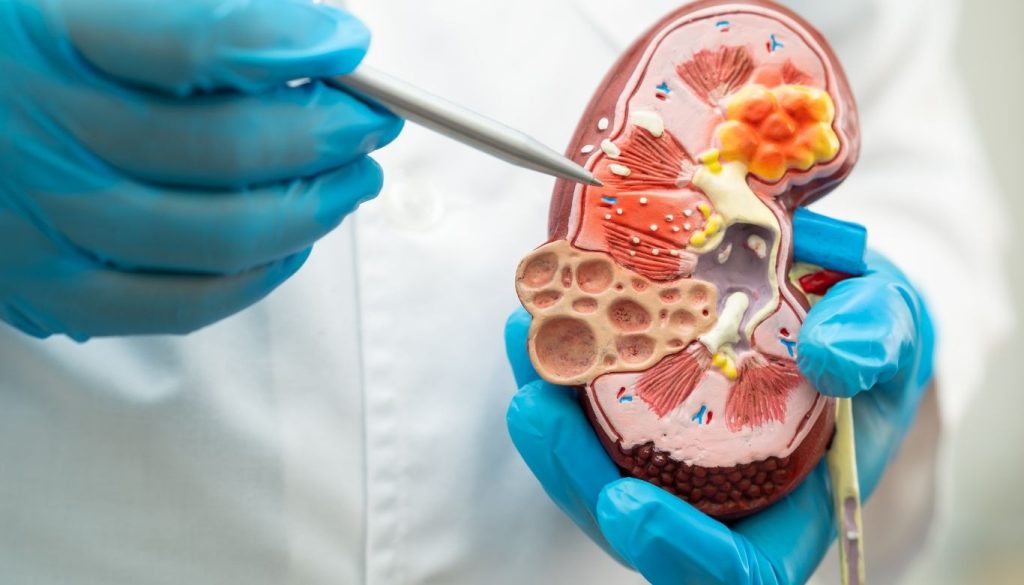 how to keep kidneys healthy​