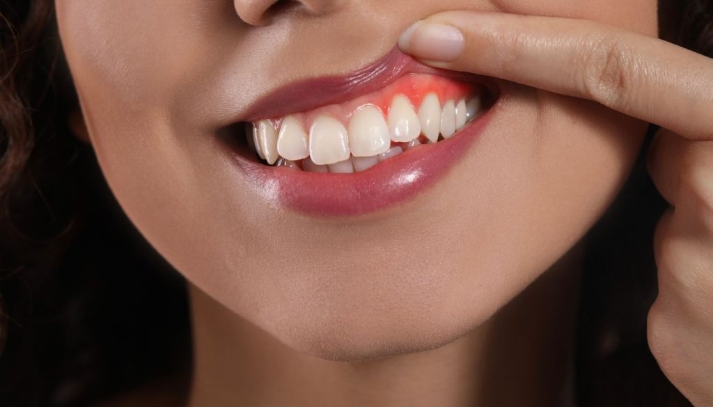 how to maintain healthy gums​ 