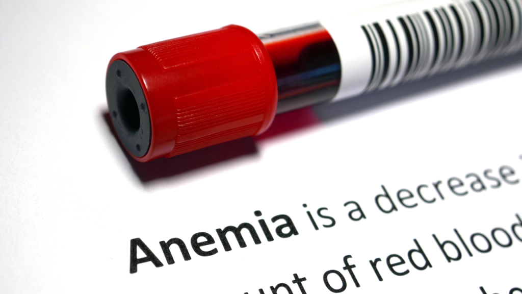 anemia constipation​