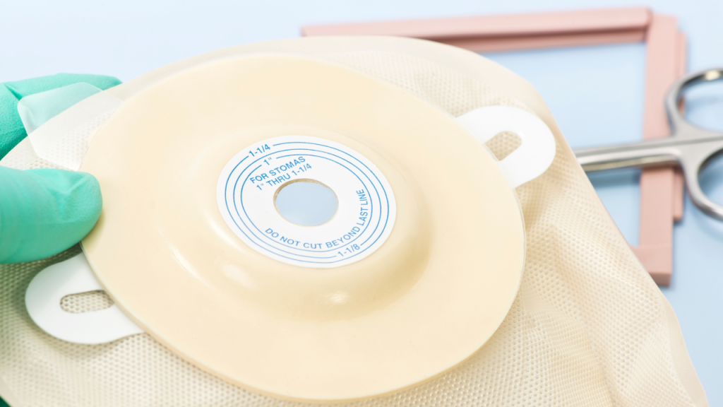 what is ostomy​