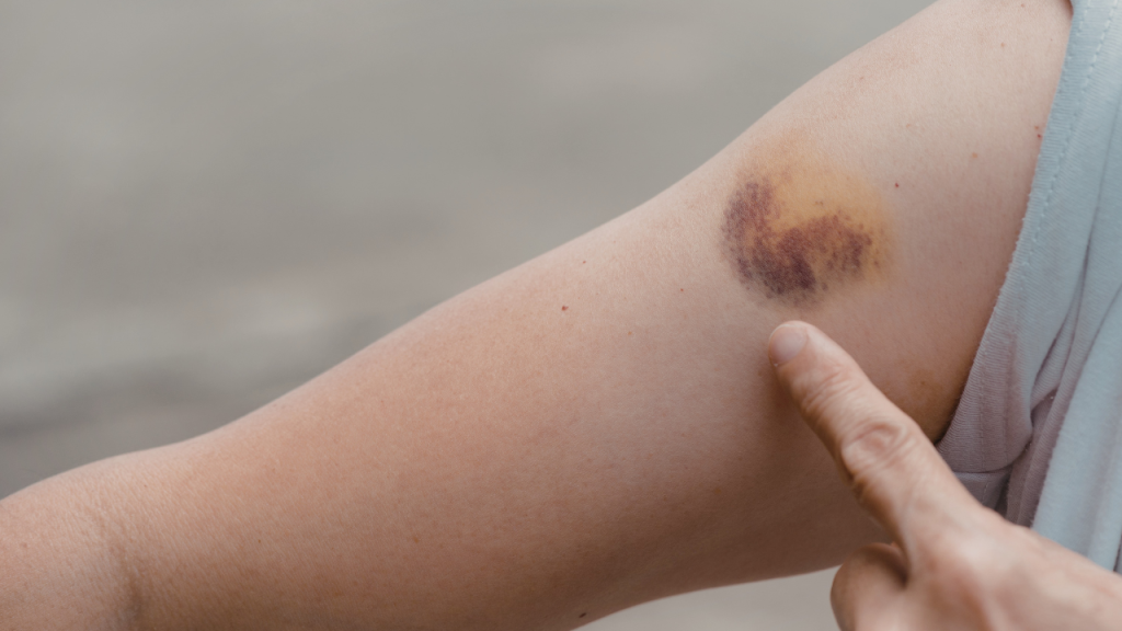 signs of high cortisol in women​