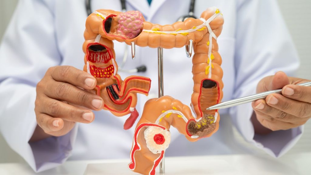 foods to avoid with irritable bowel syndrome symptoms​