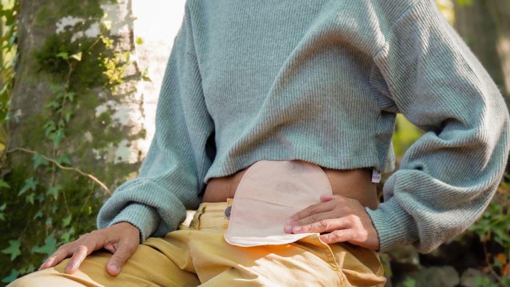 one piece vs two piece ostomy bag​