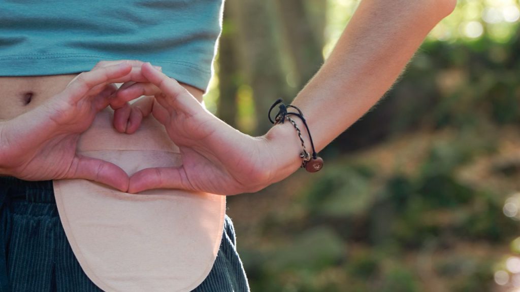 ostomy foods to eat​