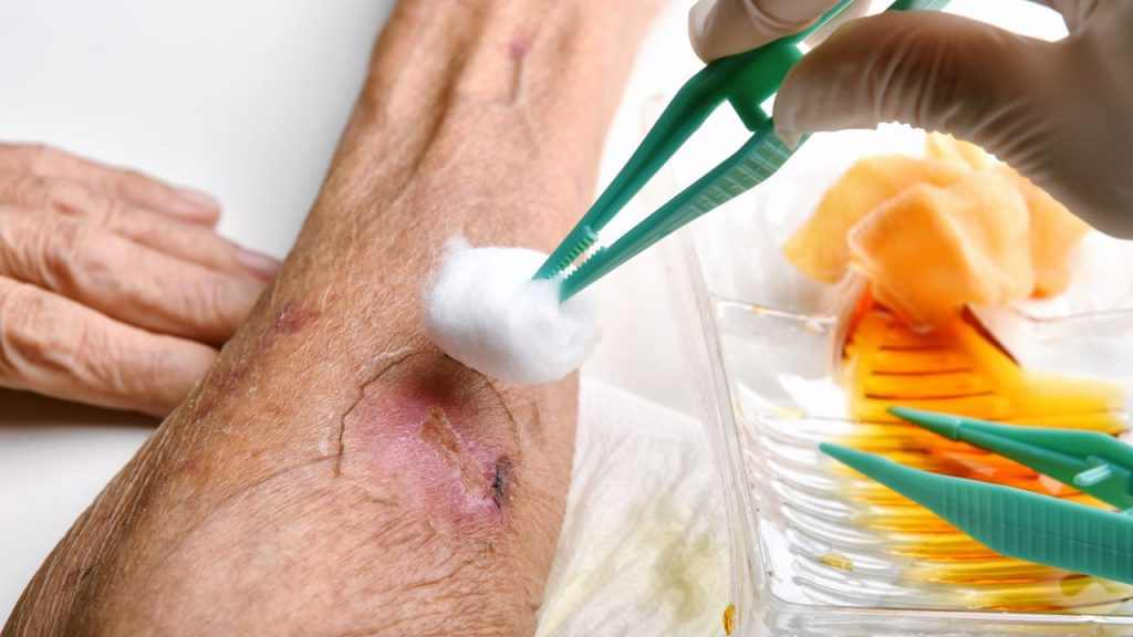 signs of infected wound​
