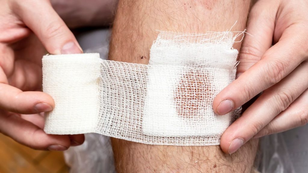 signs of infected wound​