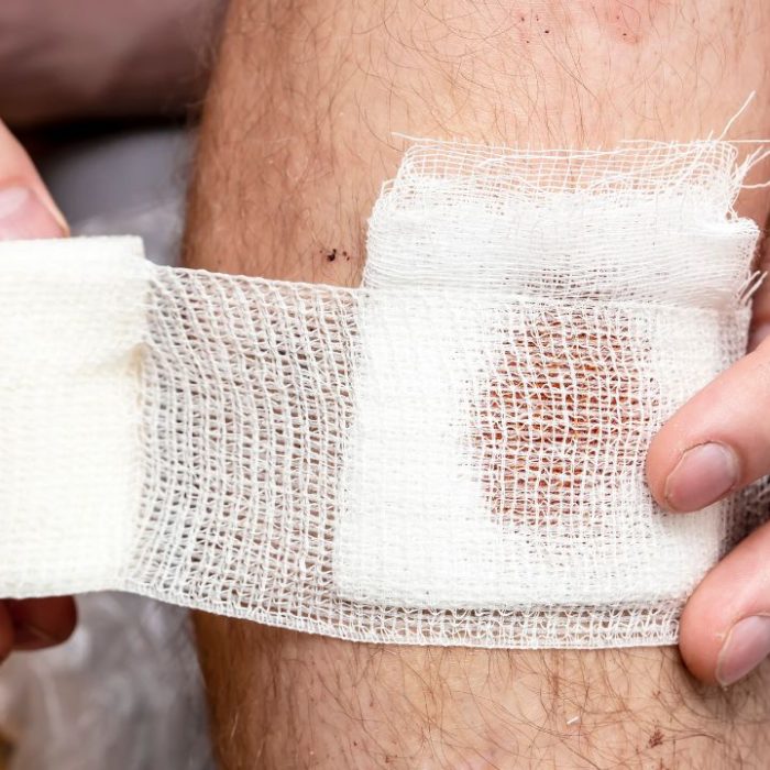 signs of infected wound​